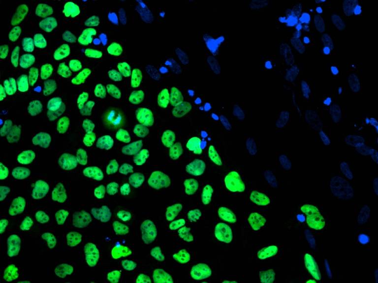 Uma linhagem de células-tronco embrionárias humanas derivada na Universidade de Stanford é vista nesta fotografia fornecida pelo Instituto da Califórnia para Medicina Regenerativa