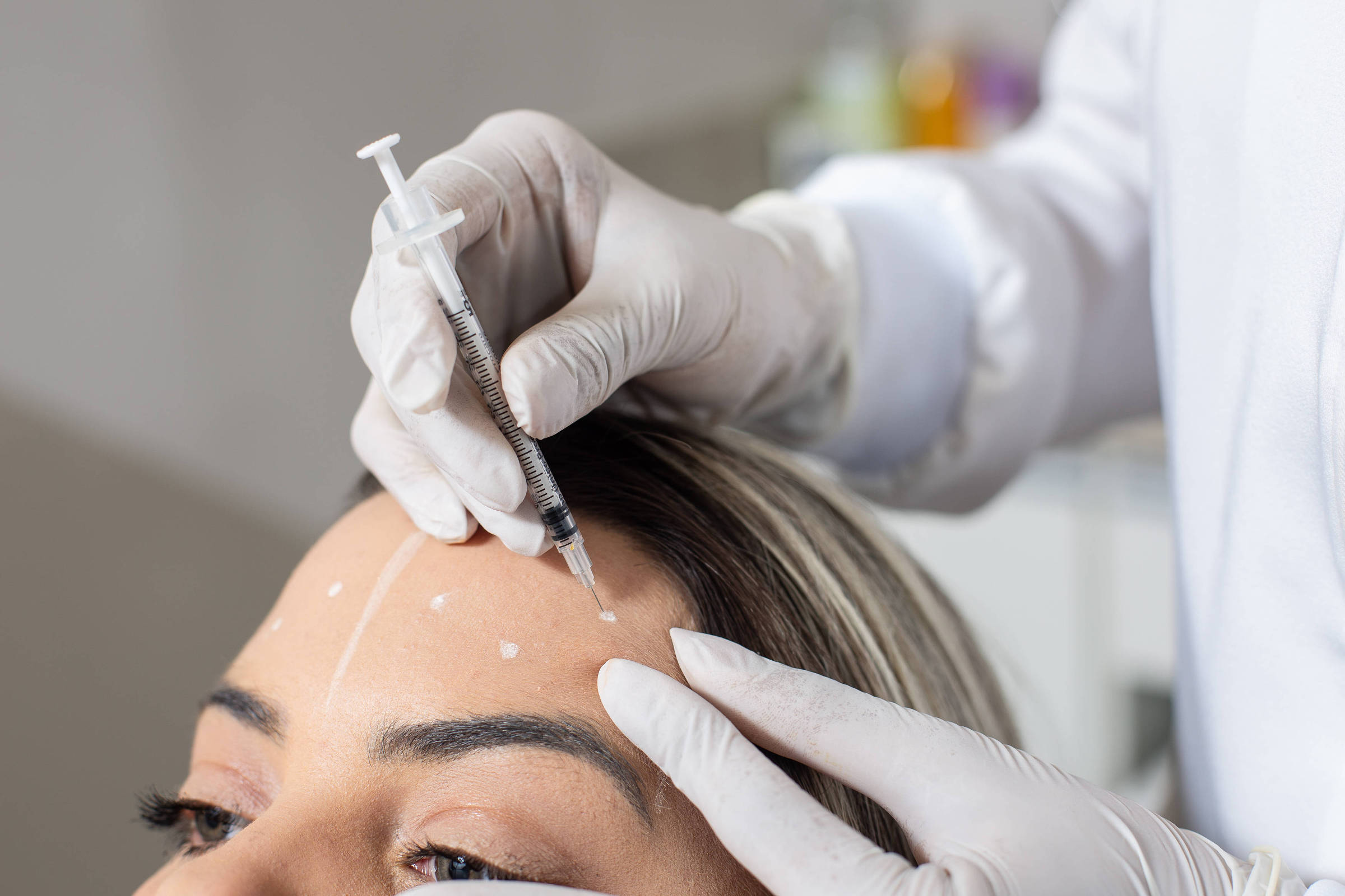 Estudo aponta que uso prolongado de canetas emagrecedoras pode reduzir duração do efeito do botox