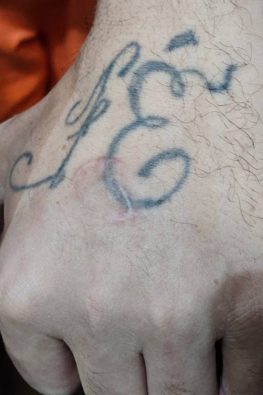 Preso mostra mão supostamente ferida com bala de borracha em unidade prisional do Ceará