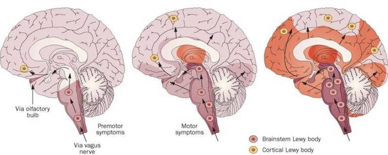Ilustração de três cérebros mostrando as ligações do nervo olfativo com o cérebro