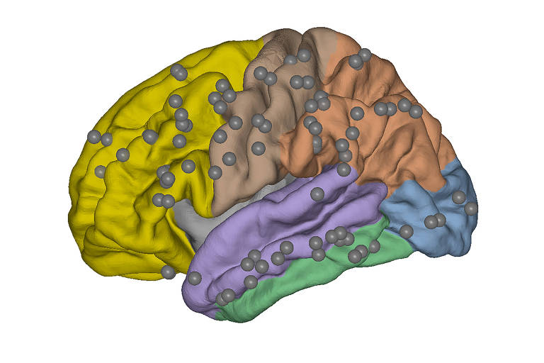 Mapa do cérebro mostrando a colocação de eletrodos intracranianos em um único paciente para um experimento realizado pelo Consórcio Cogitate usando magnetoencefalografia, que lê os campos magnéticos no cérebro