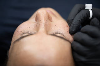 A woman during her freckles tattoo application, where the dots are first drawn on with a waterproof marker as a test placement before the real ones are later added with semipermanent liquid pigment, in New York, June 14, 2023. (Earl Wilson/The New York Times)