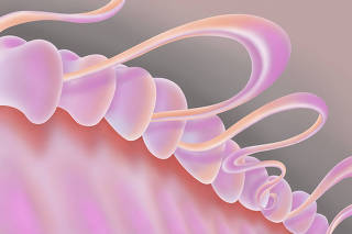 Nearly half of U.S. adults over 30 show signs of gum disease, which can cause tooth loss. (Hoi Chan/The New York Times)