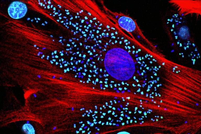 Células do coração infectadas com Trypanosoma cruzi; a estrutura maior (azul) é o núcleo da célula e as menores são os núcleos das células do parasita; em vermelho, o citoesqueleto da célula cardíaca