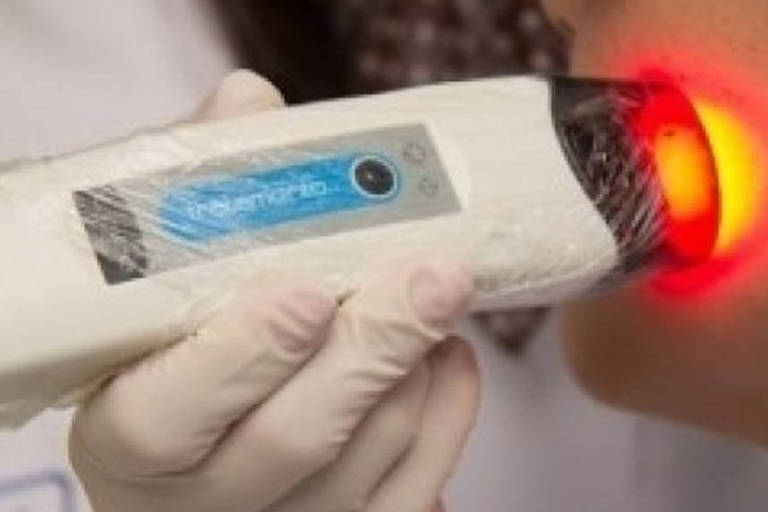 Inovação brasileira para tratar câncer de pele será utilizada no SUS
