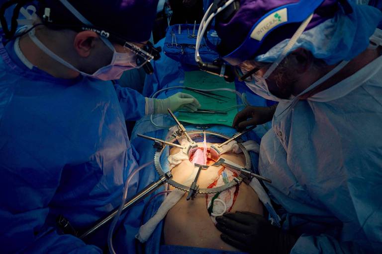 Equipe médica realiza transplante de rim de porco em paciente com morte cerebral nos EUA