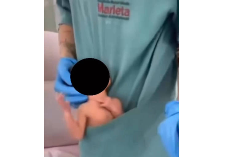Fisioterapeuta que fez 'dancinha' com bebê no bolso do jaleco vira alvo de inquérito