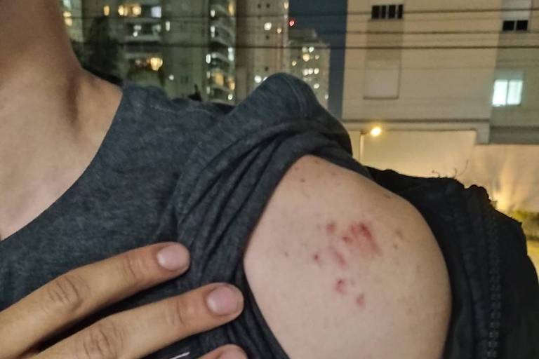 Entregador Guilherme Sanches, 25, mostra ombro ferido após supostamente ter sido agredido por um idoso na zona sul de São Paulo
