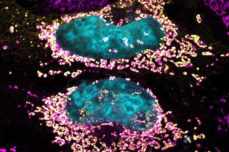 A cor azul mostra o núcleo das células; em rosa as mitocôndrias e, em amarelo, a proteína MceF; a figura evidencia a colocalização de MceF com as mitocôndrias celulares