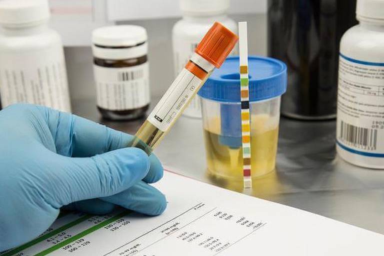 Teste de urina e outros itens em laboratório
