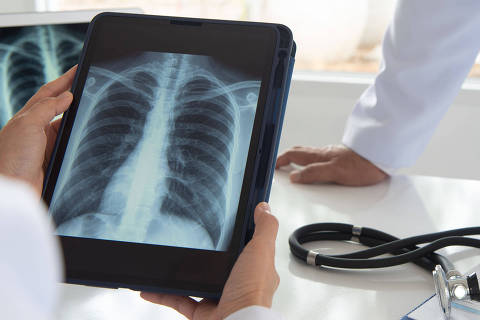 Novas perspectivas no diagnóstico e tratamento do câncer de pulmão