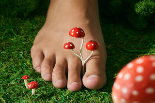 As unsightly as it is, toenail fungus is usually manageable Ñ but only with the right treatment. (Joyce Lee/The New York Times)