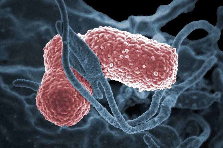 A bactéria mais comum no estudo foi a Klebsiella pneumoniae, que pode levar à pneumonia e à infecção de corrente sanguínea