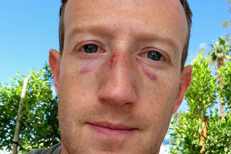 Mark Zuckerberg publica foto com hematomas no rosto: 'A luta ficou um pouco fora de controle'