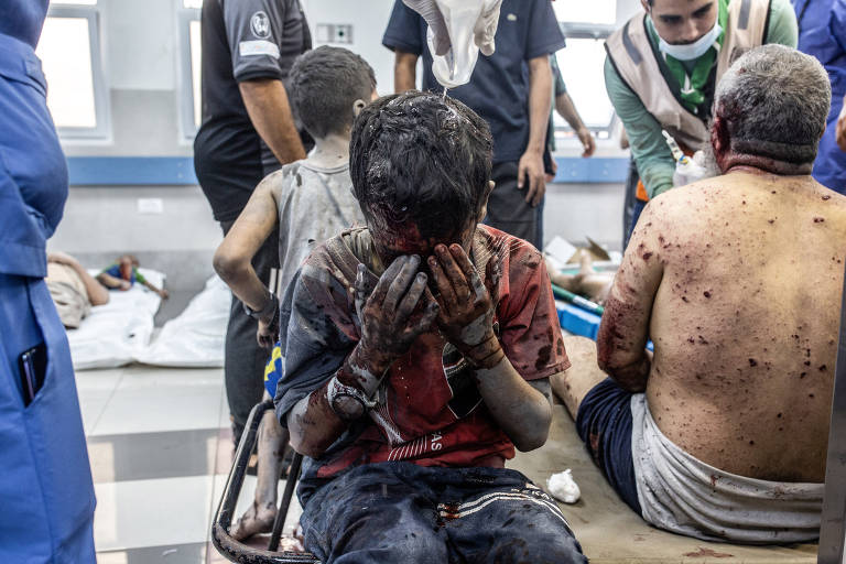 Criança ferida em bombardeios israelenses chora no hospital Al-Shifa, na cidade de Gaza