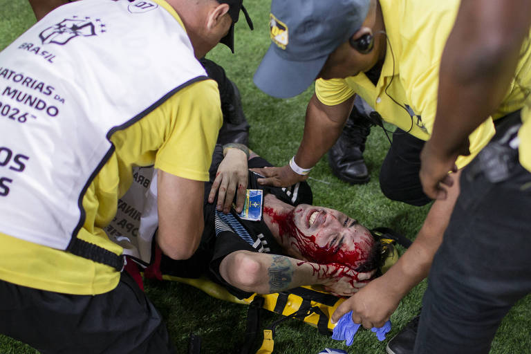 Policiais tiraram selfies com feridos, diz argentino ensanguentado no Maracanã