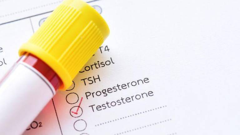 Pedido de exame para testosterona