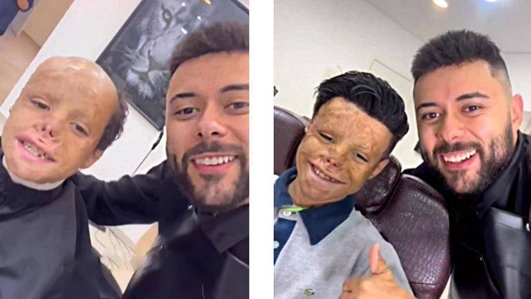 João, antes e depois de receber a prótese capilar, ao lado de Francisco, dono da barbearia

