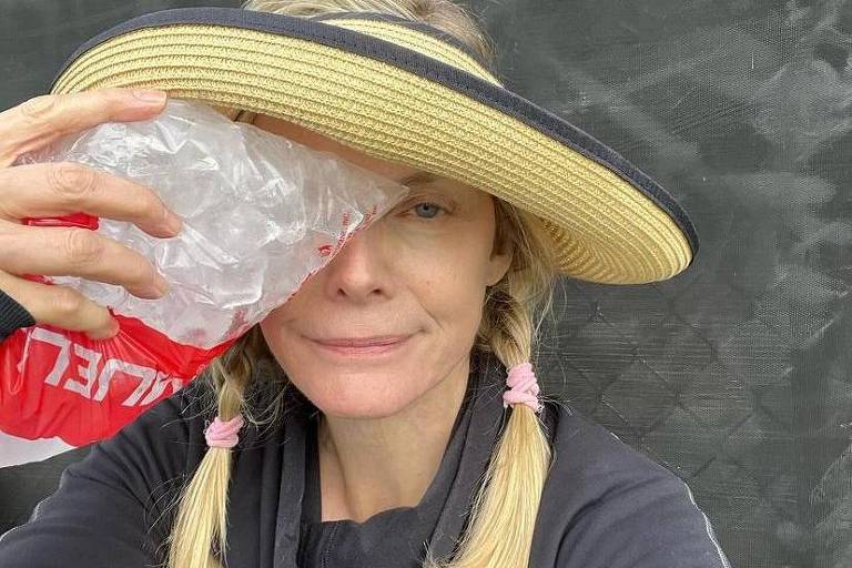 Michelle Pfeiffer aplica gelo no olho roxo