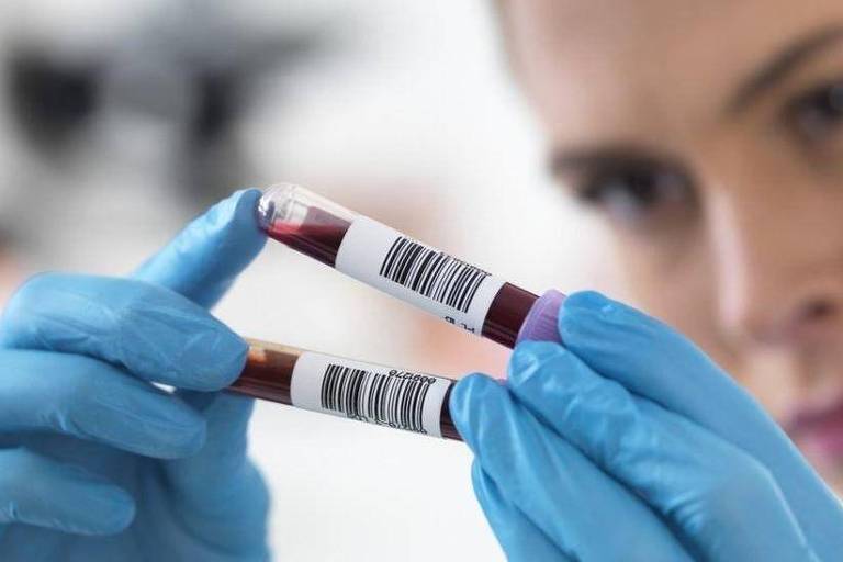 Pesquisadora segurando amostras de sangue
