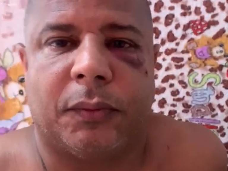Ex-jogador Marcelinho Carioca grava vídeo explicando que foi agredido após se envolver com uma mulher casada