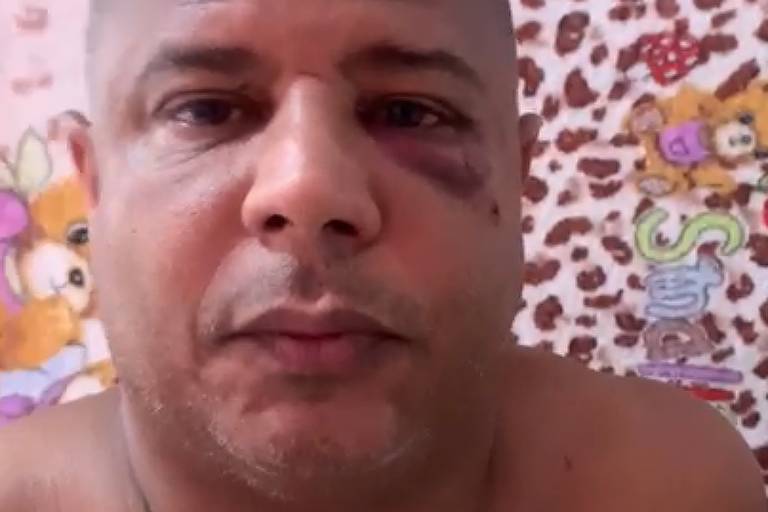 Ex-jogador Marcelinho Carioca grava vídeo explicando que foi agredido após se envolver com uma mulher casada