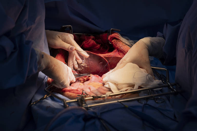 Para a retirada dos órgãos, a equipe precisa tomar cuidado para não causar nenhum ferimento; a cirurgia durou pouco mais de 2 horas