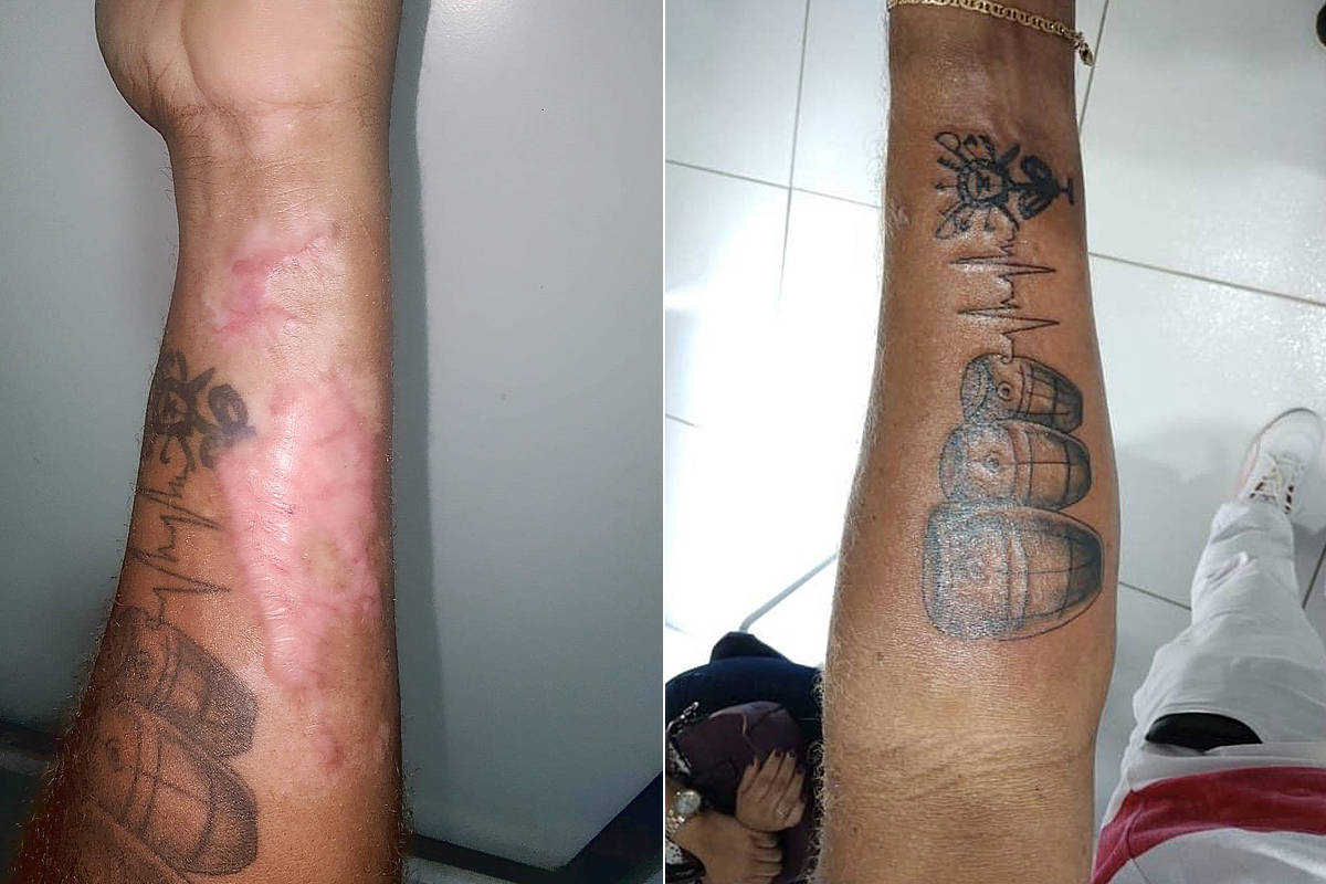 Candomblecista processará hospital por tatuagem de Ogum - 09/01/2024 -  Mônica Bergamo - Folha