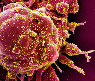 FILE PHOTO: Colorized scanning electron micrograph of apoptotic cell infected with novel coronavirus