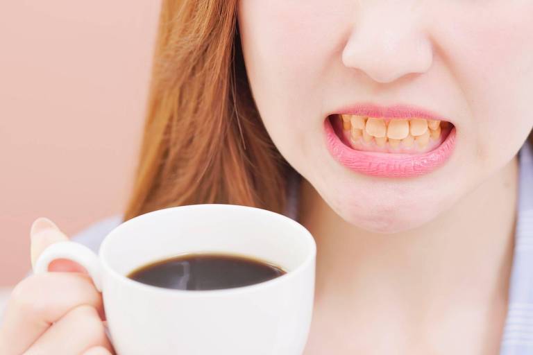Mulher com dentes amarelados segurando xícara de café

