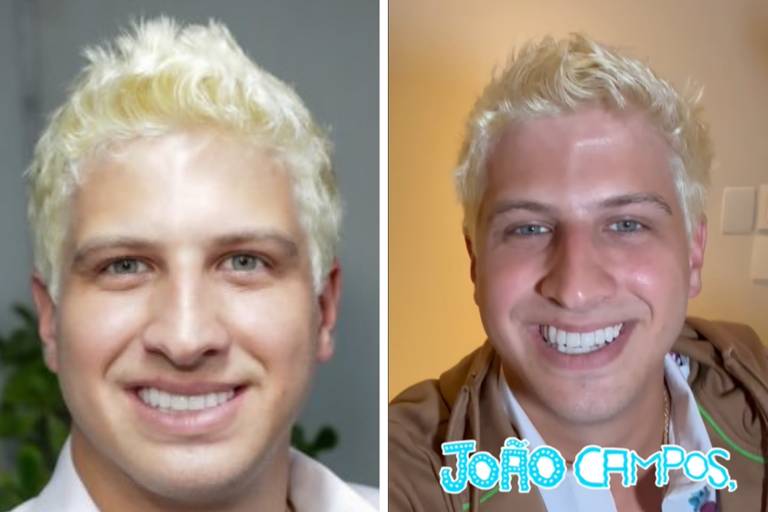 Montagem de duas fotos de João Campos, prefeito de Recife, com cabelo descolorifo