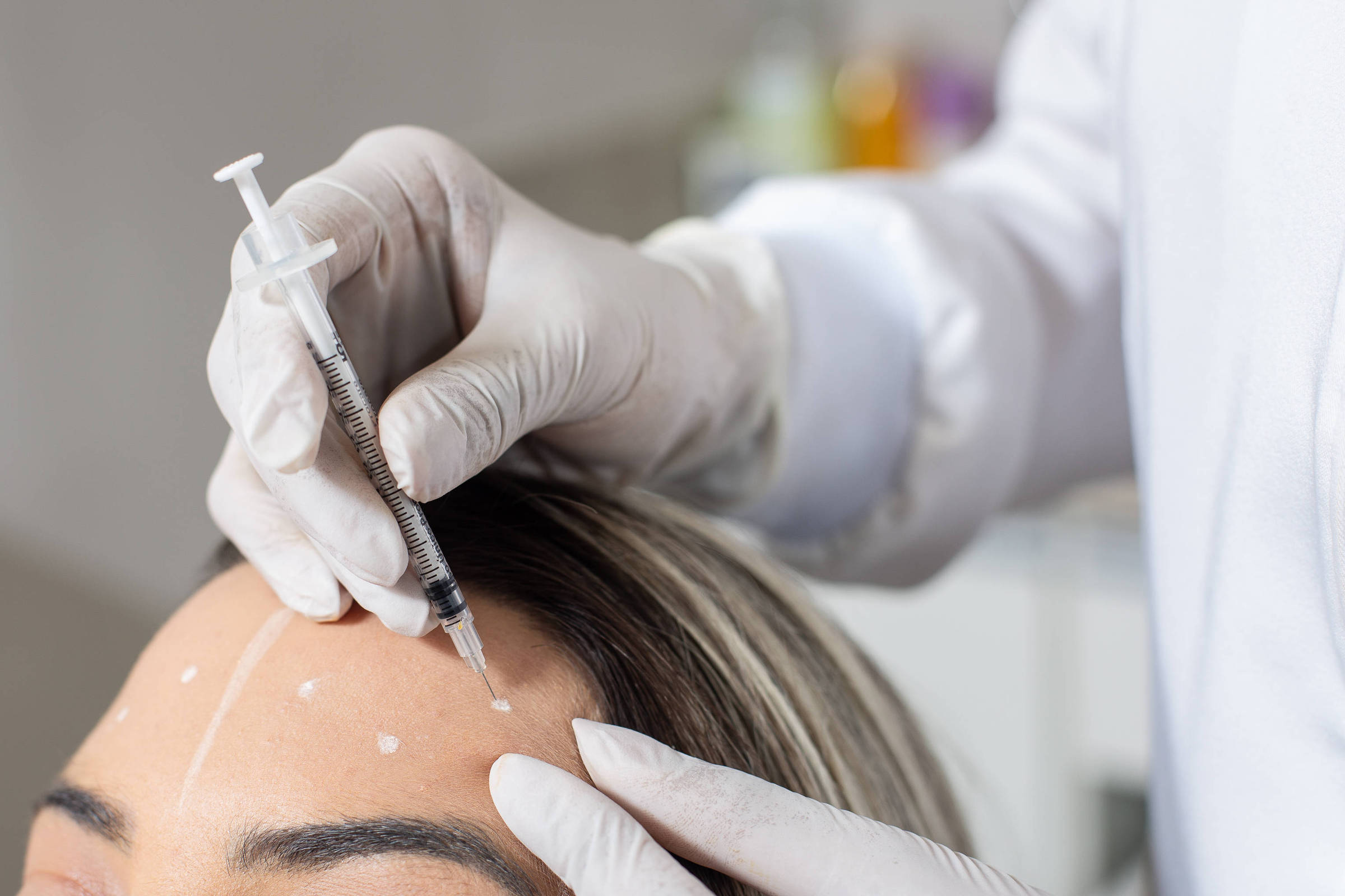 Setor de medicina estética prevê crescimento anual de 7% até 2029