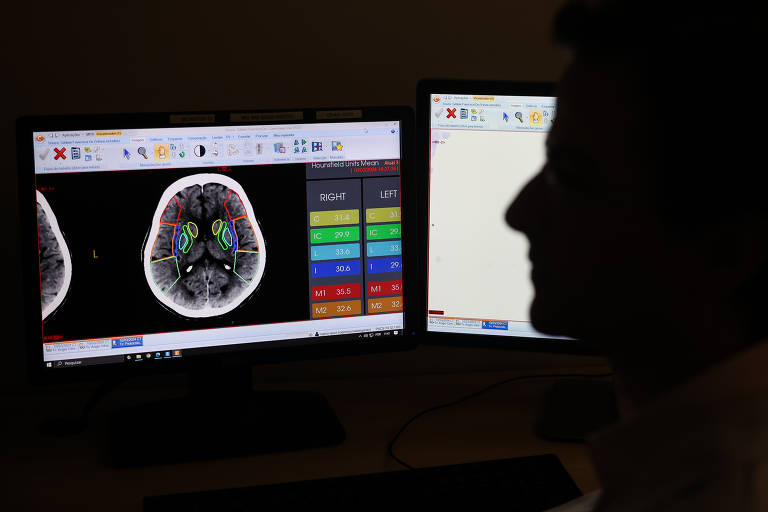 No Hospital Municipal Dr. Gilson de Cássia Marques de Carvalho, em São Paulo, a inteligência artificial é utilizada para o diagnóstico de AVC e de câncer de mama