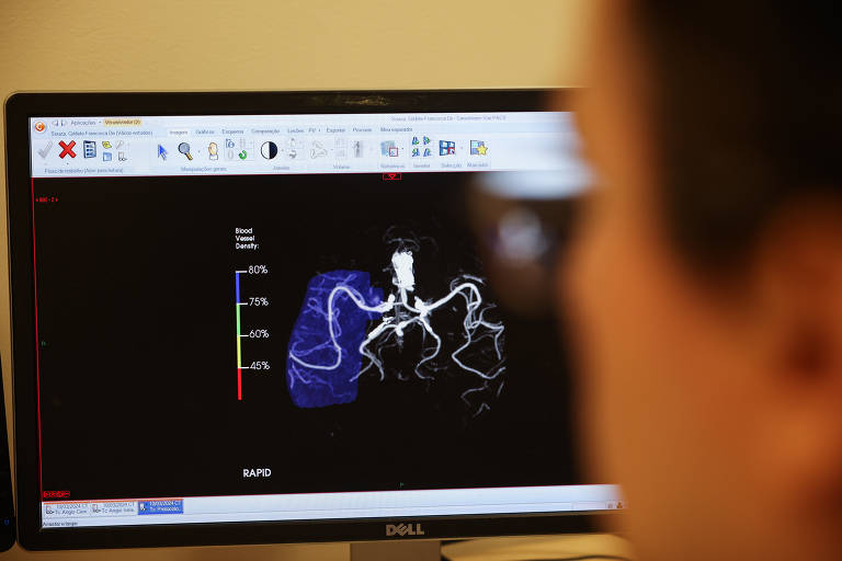 Laudos são avaliados por médicos, que só depois passam os resultados aos pacientes