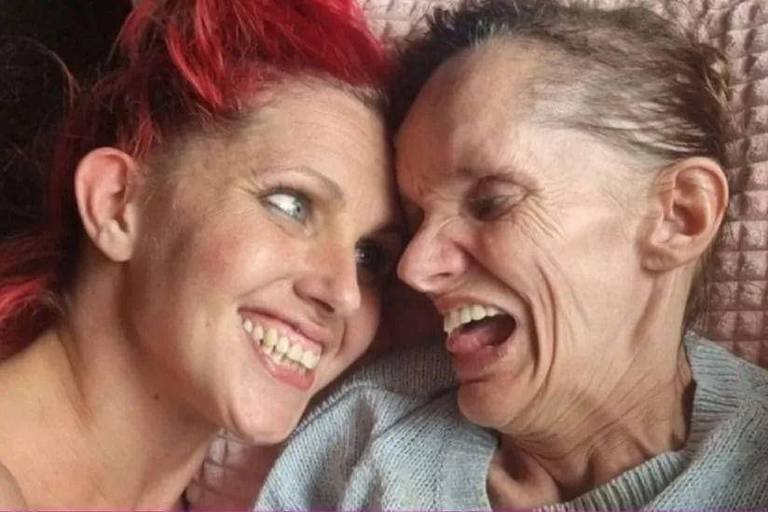 Duas mulheres brancas sorrindo e uma delas tem uma doença rara, a neuroferritinopatia