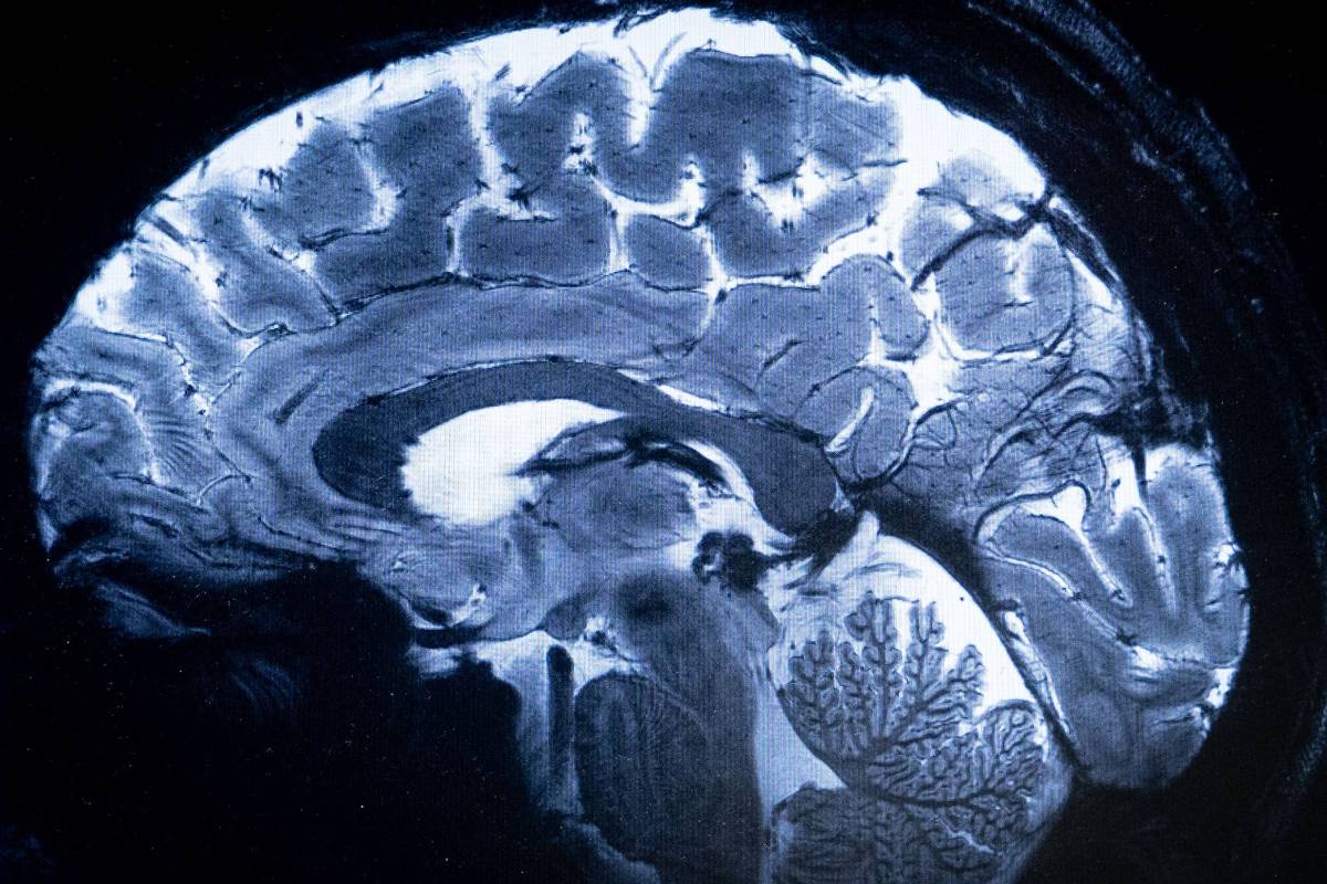 Envelhecimento cerebral é o melhor indicador de longevidade, dizem cientistas