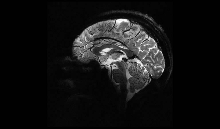 Imagem do cérebro humano feita por aparelho de ressonância magnética mais potente do mundo na França