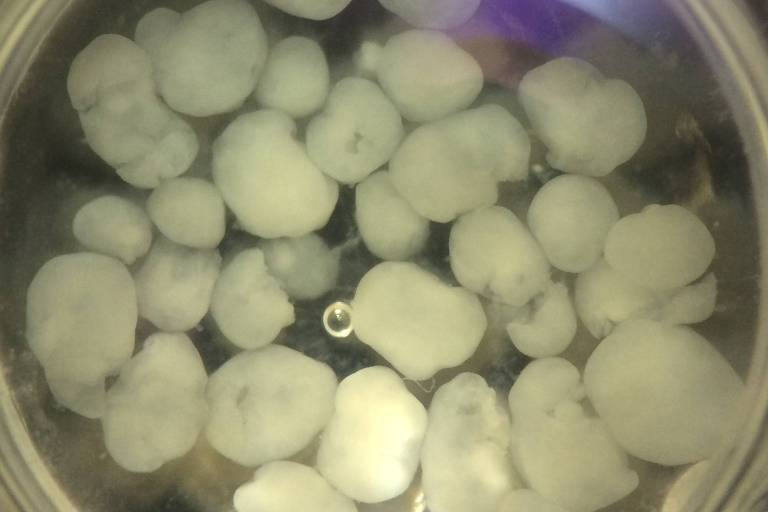 Minicérebros vistos em microscópio dentro de um tubo de ensaio