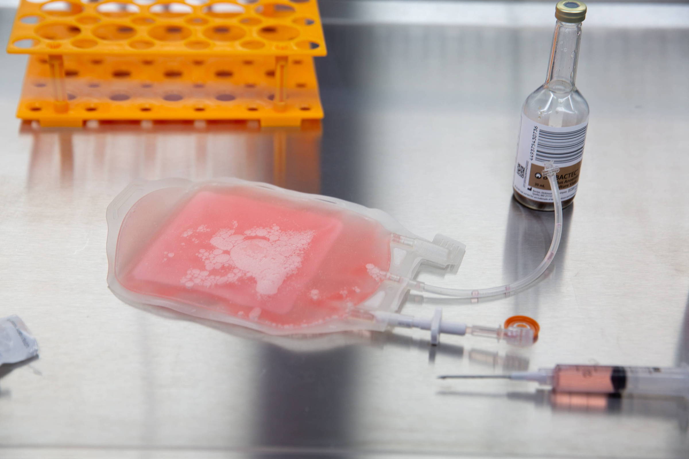 Brasil realiza primeiro estudo nacional com técnica que 'ensina' células a combater câncer