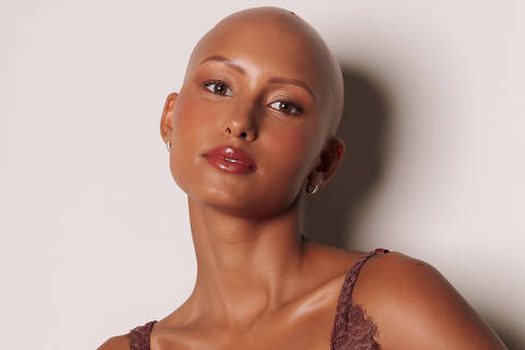 A modelo Yasmin Brito, 23, nasceu com alopecia androgenética congênita, ou seja, nunca teve cabelo