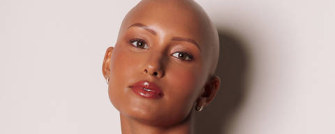 A modelo Yasmin Brito, 23, nasceu com alopecia androgenética congênita, ou seja, nunca teve cabelo