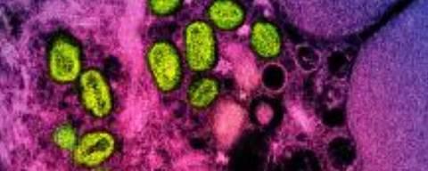 This undated image obtained from the National Institute of Allergy and Infectious Diseases (NIAID) in Bethesda, Maryland, shows a colorized transmission electron micrograph of monkeypox particles (green) found within an infected cell (pink and purple), cultured in the laboratory. - US health authorities announced on September 8, 2022, they would carry out a clinical trial to test different dosing strategies of the Jynneos monkeypox vaccine, amid uncertainty over its effectiveness. The trial will enroll 200 adults aged 18-50 across the country, and is sponsored by NIAID. The Jynneos vaccine, manufactured by Denmark-based Bavarian Nordic, has been approved by the US for the prevention of smallpox and monkeypox in people aged 18 and older. (Photo by Handout / National Institute of Allergy and Infectious Diseases / AFP) / RESTRICTED TO EDITORIAL USE - MANDATORY CREDIT 