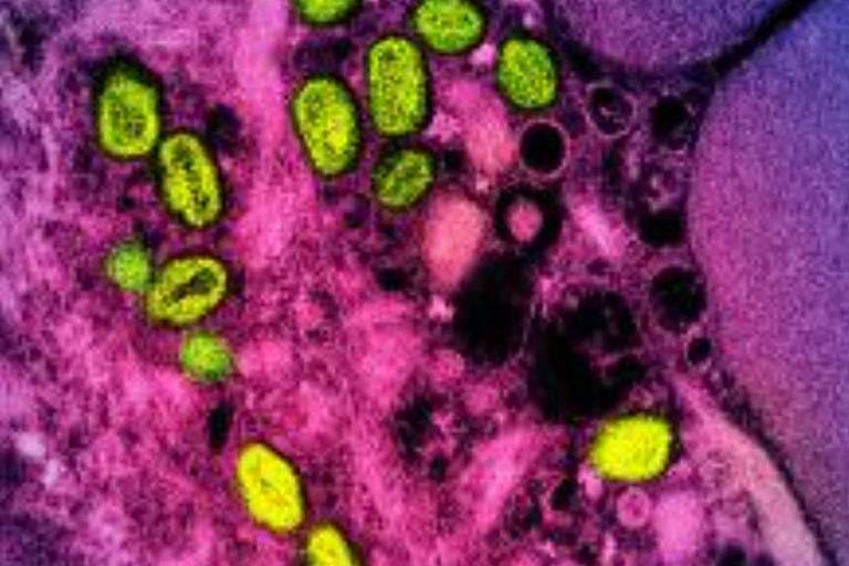 A imagem mostra uma micrografia de células, onde várias estruturas ovais e alongadas estão presentes. Essas estruturas são coloridas em verde, contrastando com o fundo que apresenta tons de roxo e rosa