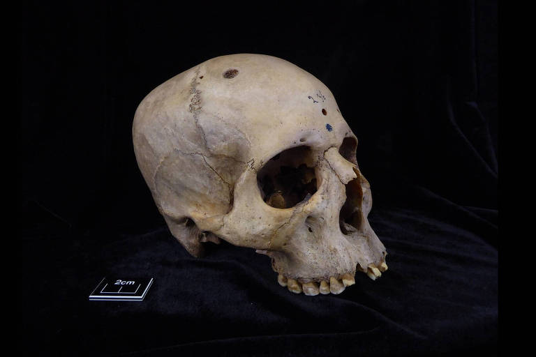 Um crânio humano sobre um tecido preto, com a mandíbula ligeiramente entreaberta