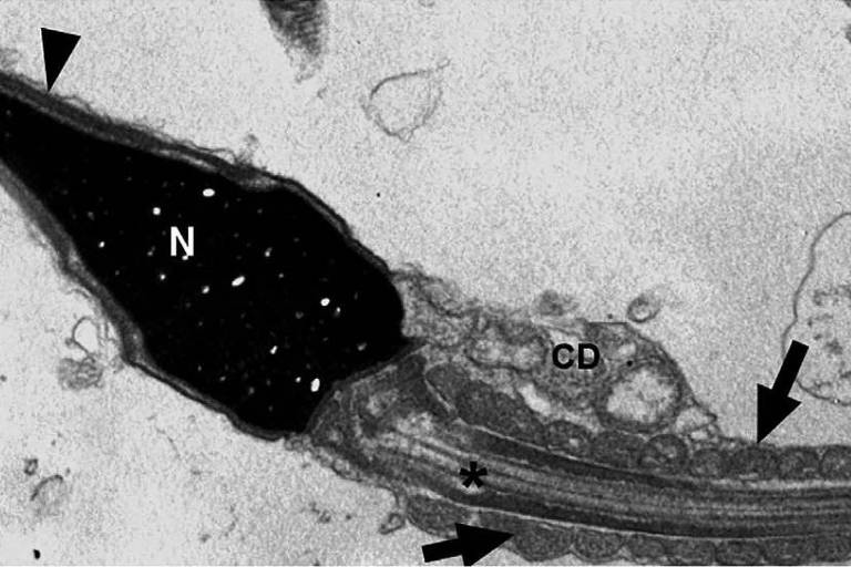 Imagem de espermatozoide de paciente com COVID-19 obtida por micrografia eletrônica