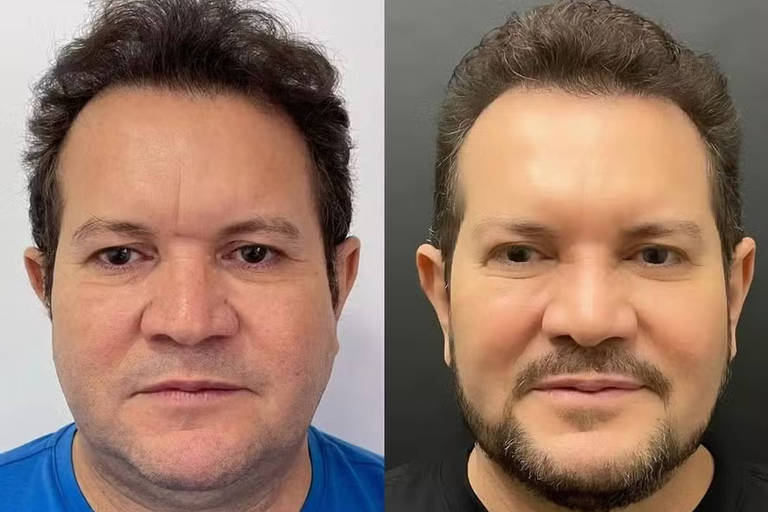 A imagem mostra duas fotos lado a lado de um homem antes e depois de uma mudança de visual. À esquerda, ele aparece com uma camiseta azul, cabelo mais desalinhado e sem barba. À direita, ele está com uma camiseta preta, cabelo arrumado e uma barba bem aparada, exibindo um sorriso sutil e uma aparência mais refinada.