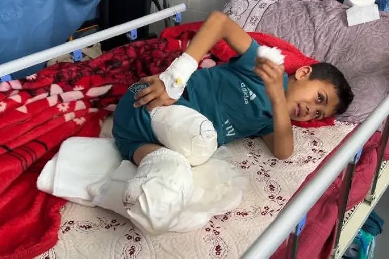 Um jovem paciente repousa em uma cama de hospital, exibindo suas duas pernas amputadas, com curativos