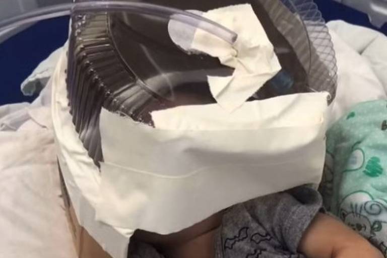 Médica improvisa embalagem de bolo como máscara de oxigênio para salvar bebê no RN