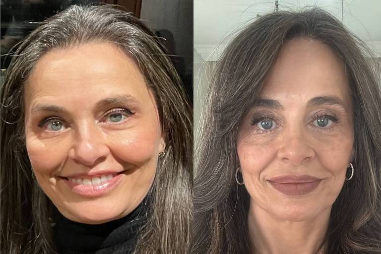 Carla Vilhena posta antes e depois no Instagram