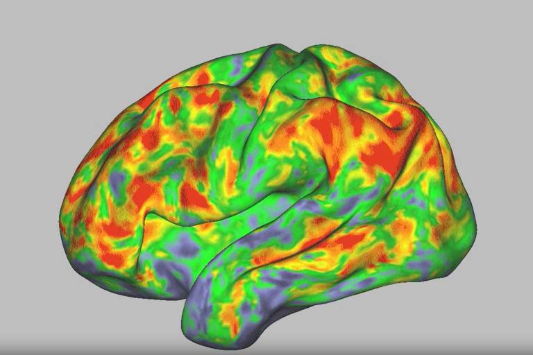 Imagem de um modelo tridimensional de um cérebro, exibindo uma superfície ondulada com cores vibrantes em verde, vermelho, amarelo e azul, representando diferentes áreas ou atividades cerebrais. O fundo é cinza.